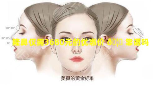 隆鼻仅需3680元的优惠价 🦟 靠谱吗